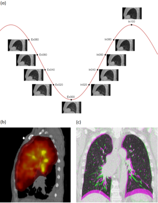 Figure 1. Example of images in the collection. (a) 10-phase 4DCT scans, (b) overlay of PET and attenuation CT scans, (c) overlay of inhale and exhale BHCT scans.