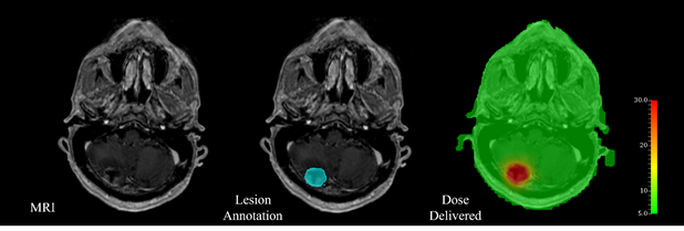 Brain Test : Level 23, Brain Test Wiki