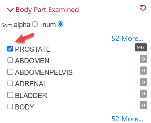 Body Part Examined search filter showing Prostate selected