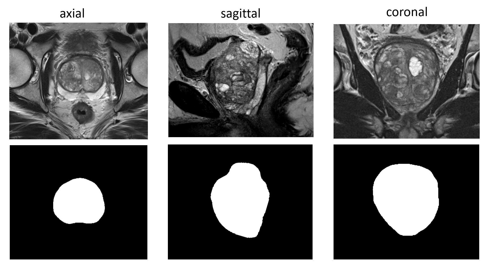 Example of a high resolution segmentation. The segmentation is smooth in all directions and does not suffer from step artifacts